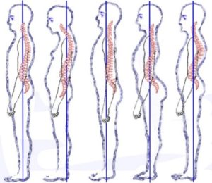 posture types image