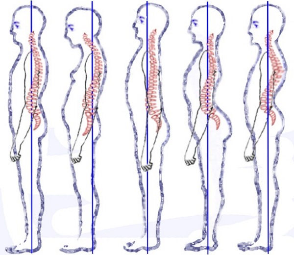 posture types image