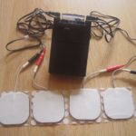 electric stimulation machine