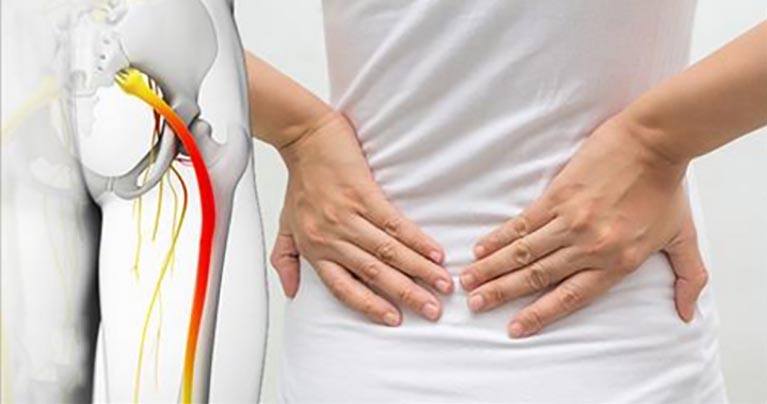 sciatica nerve and lower back pain