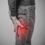 sciatica pain